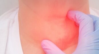 Problemi alla tiroide? Attenzione agli alimenti “gozzigeni”, ecco quali sono