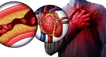 Scopri i 10 supercibi segreti che purificano le arterie e riducono il colesterolo cattivo!
